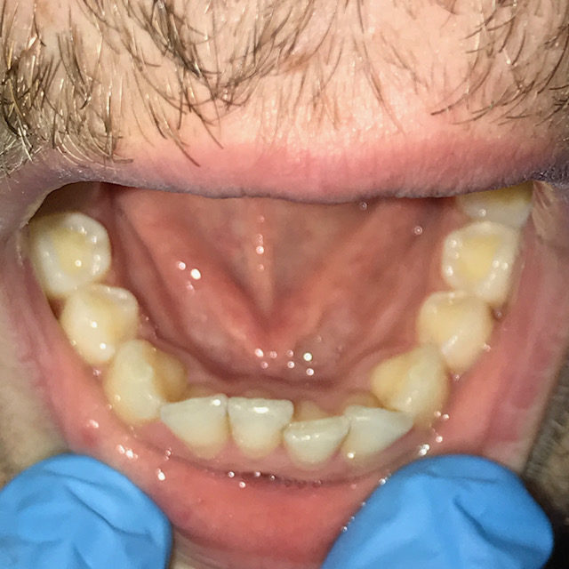 inicio-tratamiento-ortodoncia