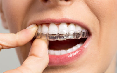 Realiza tu tratamiento de Invisalign en Barcelona Dental Center